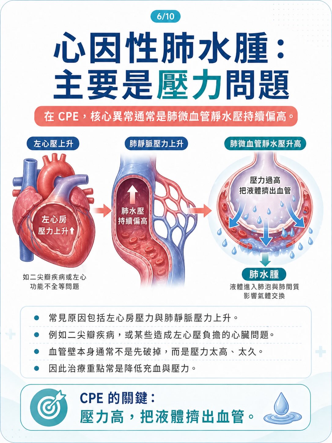不是所有肺水腫，都來自心臟圖卡 6