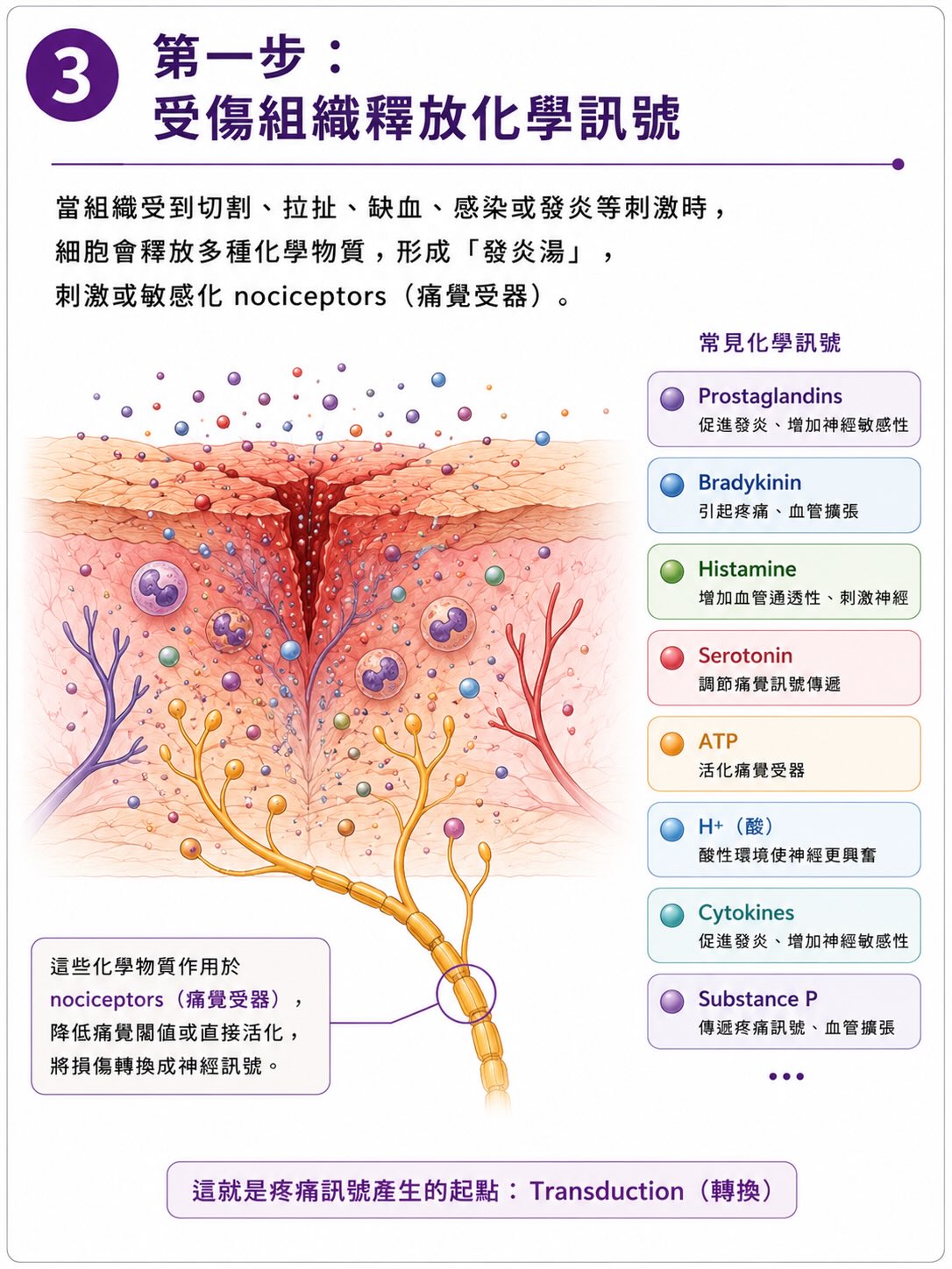 疼痛不是從傷口開始，而是在大腦完成圖卡 3