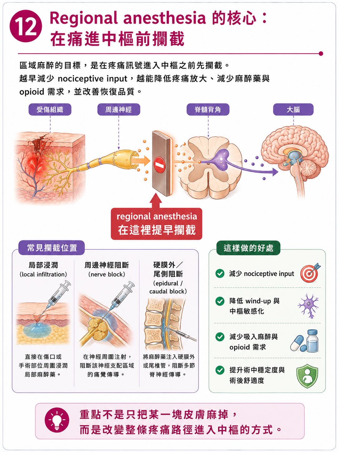 疼痛不是從傷口開始，而是在大腦完成圖卡 12