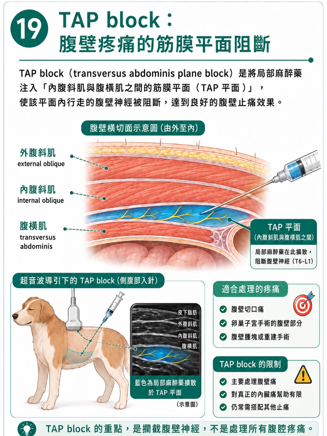 疼痛不是從傷口開始，而是在大腦完成圖卡 19