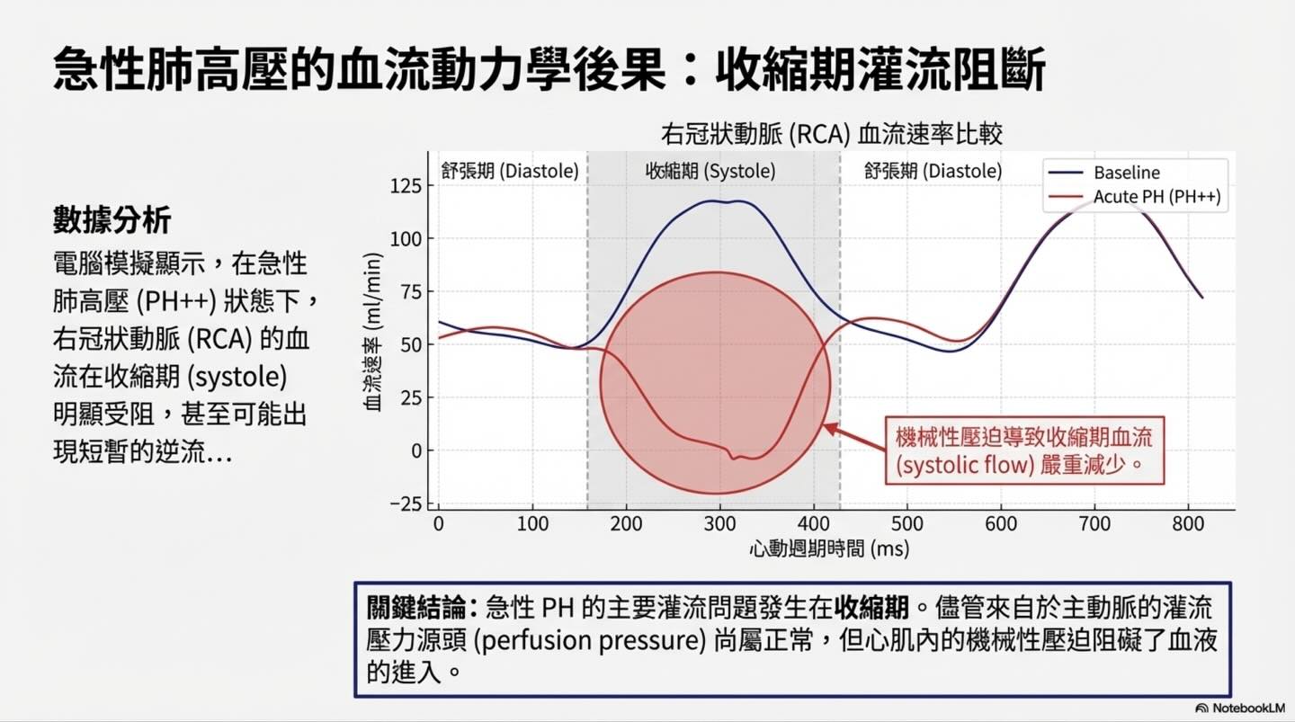 肺高壓的致命螺旋：右心室冠狀動脈灌流與心肌缺氧圖卡 6