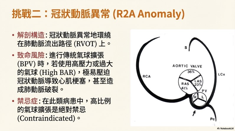 TPSA｜肺動脈瓣支架置放術圖卡 4：挑戰二：冠狀動脈異常（R2A Anomaly）